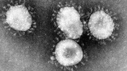 What is Coronavirus and How to Avoid It