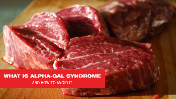 What Is Alpha-gal Syndrome and How to Avoid It